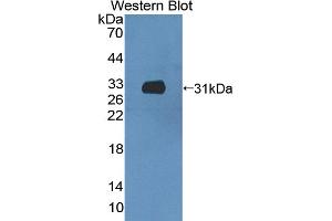 Detection of Recombinant CCDC60, Mouse using Polyclonal Antibody to Coiled Coil Domain Containing Protein 60 (CCDC60) (CCDC60 anticorps  (AA 1-186))