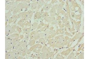 Immunohistochemistry of paraffin-embedded human heart tissue using ABIN7157743 at dilution of 1:100