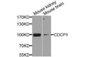 Western blot analysis of extracts of various cell lines, using CDCP1 antibody. (CDCP1 anticorps  (AA 30-343))