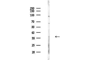 anti-Mohawk Homeobox (MKX) (C-Term) antibody