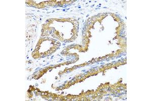 Immunohistochemistry of paraffin-embedded human prostate using NCK2 antibody at dilution of 1:100 (x40 lens). (NCK2 anticorps)