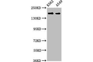 Western Blot Positive WB detected in: K562 whole cell lysate, A549 whole cell lysate All lanes: FMN1 antibody at 3. (FMN1 anticorps  (AA 354-487))