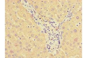 Immunohistochemistry of paraffin-embedded human liver tissue using ABIN7170841 at dilution of 1:100