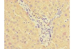 Immunohistochemistry of paraffin-embedded human liver tissue using ABIN7170841 at dilution of 1:100 (SMAP1 anticorps  (AA 1-280))