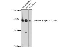 Western blot analysis of extracts of various cell lines, using Collagen III alpha 1/COL3 antibody (ABIN7266459) at 1:1000 dilution.