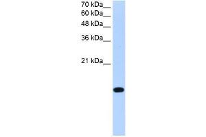 BATF2 antibody used at 0. (BATF2 anticorps  (Middle Region))