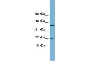 WB Suggested Anti-DUSP10 Antibody Titration: 0. (DUSP10 anticorps  (N-Term))