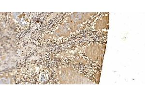 IHC analysis of PSMD8 using anti-PSMD8 antibody (ABIN7602571).