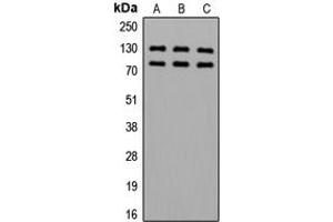 Western blot analysis of Alpha-adducin (pS726/713) expression in HeLa (A), SP2/0 (B), PC12 (C) whole cell lysates. (alpha Adducin anticorps  (C-Term, pSer713, pSer726))