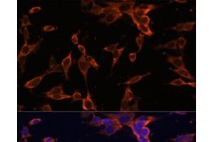 Immunofluorescence analysis of NIH-3T3 cells using USP36 Polyclonal Antibody at dilution of 1:100 (40x lens). (USP36 anticorps)