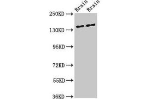 Western Blot Positive WB detected in: Rat brain tissue, Mouse brain tissue All lanes: MAST3 antibody at 3 μg/mL Secondary Goat polyclonal to rabbit IgG at 1/50000 dilution Predicted band size: 144 kDa Observed band size: 144 kDa (MAST3 anticorps  (AA 1101-1309))