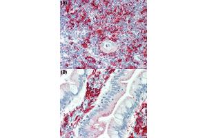 Immunohistochemical staining (Formalin-fixed paraffin-embedded sections) of human thymus tissue (A) and human small intestine tissue (B) using HLA Class II beta chains (DP, DQ, DR) monoclonal antibody, clone WR18  under 10 ug/mL working concentration. (HLA-DRB1 anticorps)