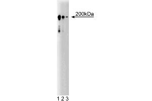Western blot analysis of CD104 (Integrin beta4) on a A431 cell lysate (Human epithelial carcinoma, ATCC CRL-1555). (Integrin beta 4 anticorps  (AA 1612-1821))