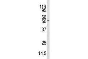 Western blot analysis of CAMKK antibody and mouse cerebellum tissue lysate.