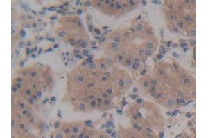 Detection of Rock2 in Human Stomach Tissue using Polyclonal Antibody to Rho Associated Coiled Coil Containing Protein Kinase 2 (Rock2)