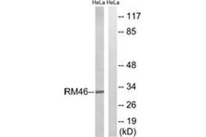 Western Blotting (WB) image for anti-Mitochondrial Ribosomal Protein L46 (MRPL46) (AA 111-160) antibody (ABIN2879174) (MRPL46 anticorps  (AA 111-160))