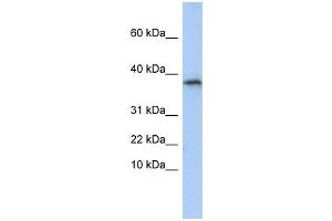 GLYAT antibody used at 1 ug/ml to detect target protein. (GLYAT anticorps  (N-Term))