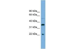 WB Suggested Anti-DOK6 Antibody Titration: 0. (DOK6 anticorps  (Middle Region))