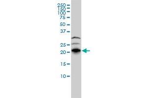 RHOJ monoclonal antibody (M01), clone 1E4 Western Blot analysis of RHOJ expression in HepG2 (RHOJ anticorps  (AA 1-214))