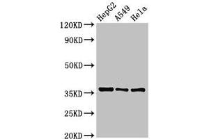Western Blot Positive WB detected in: HepG2 whole cell lysate, A549 whole cell lysate, Hela whole cell lysate All lanes: ECH1 antibody at 2. (ECH1 anticorps  (AA 36-135))