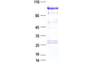 Validation with Western Blot