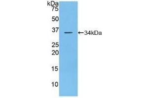 Detection of Recombinant DEP1, Mouse using Polyclonal Antibody to Density Enhanced Phosphatase 1 (DEP1)