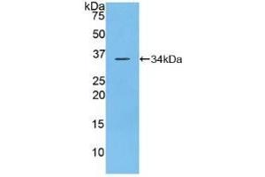 Detection of Recombinant DEP1, Mouse using Polyclonal Antibody to Density Enhanced Phosphatase 1 (DEP1) (PTPRJ anticorps  (AA 567-842))