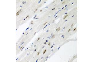 Immunohistochemistry of paraffin-embedded mouse heart using CDC27 antibody (ABIN5975347) at dilution of 1/200 (40x lens).