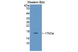 Western blot analysis of the recombinant protein. (VEGFB anticorps  (AA 22-137))