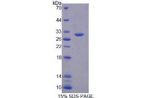 SDS-PAGE analysis of Human MED8 Protein. (MED8 Protéine)