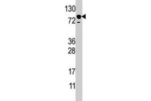 Western blot analysis of EPS15 polyclonal antibody  in HL-60 cell line lysate (35 ug/lane). (EPS15 anticorps  (C-Term))