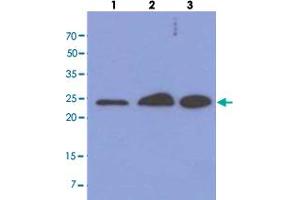 Western blot analysis of cell lysates (each 40 ug) by MRRF monoclonal antibody, clone AT7D10  (1:1000). (MRRF anticorps  (AA 56-262))