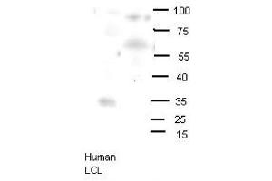 OLIG2 antibody - N-terminal region  validated by WB using human LCL and mouse brains at 1:1000.