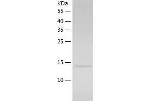 Western Blotting (WB) image for TNF Receptor-Associated Factor 1 (TRAF1) (AA 266-416) protein (His-IF2DI Tag) (ABIN7125406)