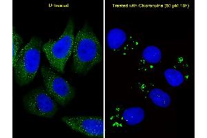 Fluorescent image of  cells stained with ATG5 Antibody (C-term) (ABIN388519 and ABIN2849632). (ATG5 anticorps  (C-Term))