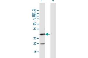 Western Blot analysis of DUT expression in transfected 293T cell line by DUT MaxPab polyclonal antibody. (Deoxyuridine Triphosphatase (DUT) (AA 1-252) anticorps)
