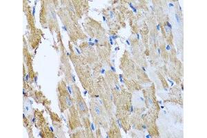 Immunohistochemistry of paraffin-embedded Rat heart using CCM2 Polyclonal Antibody at dilution of 1:100 (40x lens). (CCM2 anticorps)
