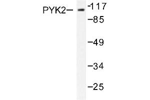 Image no. 1 for anti-PTK2B Protein tyrosine Kinase 2 beta (PTK2B) antibody (ABIN271907) (PTK2B anticorps)