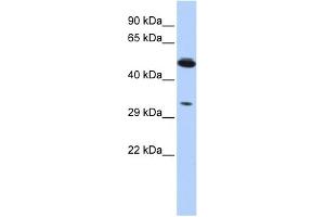 WB Suggested Anti-PIK3IP1 Antibody Titration:  0. (PIK3IP1 anticorps  (Middle Region))