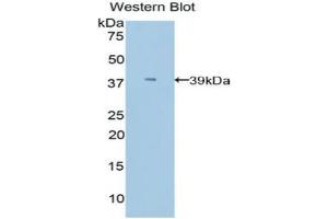 Western blot analysis of the recombinant protein. (APOC1 anticorps  (AA 30-88))