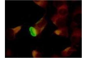 Immunofluorescence (IF) image for anti-Herpes Simplex Virus Type 2 ICP8 (HSV2 ICP8) antibody (ABIN265566) (HSV2 ICP8 anticorps)