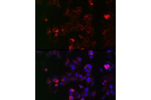 Immunofluorescence analysis of HepG2 cells using NOX1 Rabbit pAb (ABIN6133827, ABIN6144746, ABIN6144748 and ABIN6215916) at dilution of 1:50 (40x lens). (NOX1 anticorps  (AA 200-300))