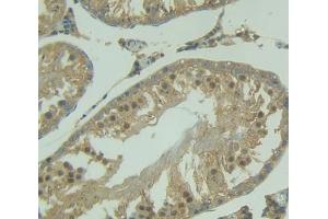 IHC-P analysis of Kidney tissue, with DAB staining. (NUP50 anticorps  (AA 179-428))