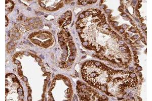 ABIN6278260 at 1/100 staining Human kidney tissue by IHC-P. (Selenoprotein P anticorps)