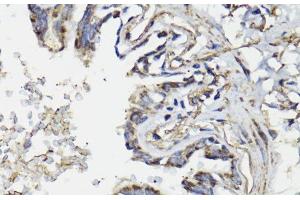 Immunohistochemistry of paraffin-embedded Human lung using WASF3 Polyclonal Antibody at dilution of 1:100 (40x lens). (WASF3 anticorps)