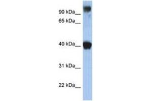 Image no. 1 for anti-Transcription Factor AP-2 epsilon (Activating Enhancer Binding Protein 2 Epsilon) (TFAP2E) (N-Term) antibody (ABIN6742240)