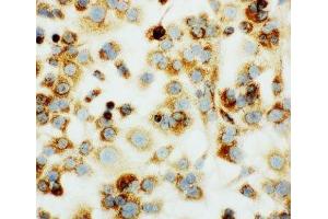 ICC: HEPA cells (COX1 anticorps  (C-Term))