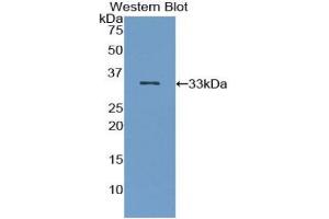 Western blot analysis of the recombinant protein. (IRAK2 anticorps  (AA 235-521))