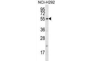 Western Blotting (WB) image for anti-F-Box Protein 15 (FBXO15) antibody (ABIN2996731) (FBXO15 anticorps)