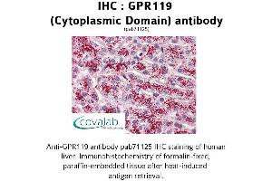 Image no. 2 for anti-G Protein-Coupled Receptor 119 (GPR119) (3rd Cytoplasmic Domain) antibody (ABIN1734912) (G Protein-Coupled Receptor 119 anticorps  (3rd Cytoplasmic Domain))